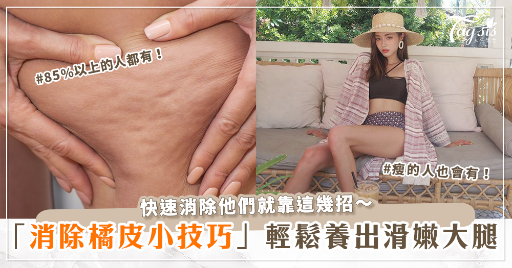 85%以上的人都有！消滅「橘皮組織問題」全攻略 輕鬆養出讓男人吞口水的「遐想嫩腿」～